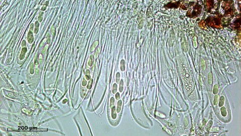 Pathogene