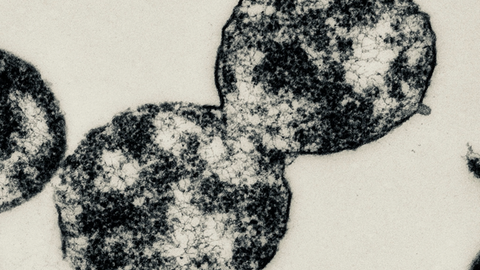 Mycoplasma cells seen under electron microscopy 