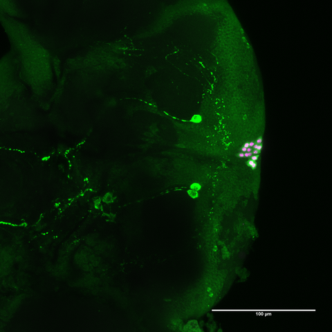 Insulin-producing cells