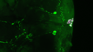 Insulin-producing cells