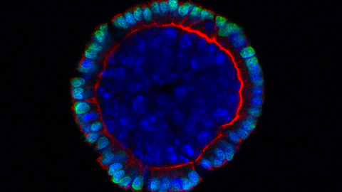 Fluorescent stained intestinal organoid