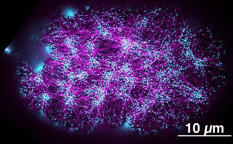 Bild des Aktomyosin-Kortex in einem einzelligen Embryo, aufgenommen mit hochauflösender Fluoreszenzmikroskopie. Die Aktinfilamente sind magentafarben markiert, die Bereiche, in denen Kräfte und Drehmomente erzeugt werden, sind cyanfarben markiert. 