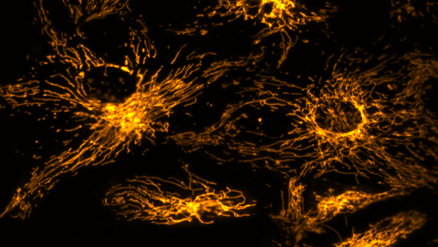 Mikroskopische Aufnahme.Orangefarbene Formen und Linien auf einem schwarzen Hintergrund.