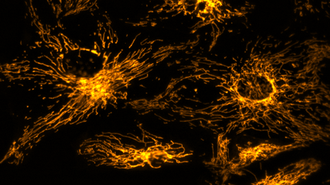 Mikroskopische Aufnahme.Orangefarbene Formen und Linien auf einem schwarzen Hintergrund.