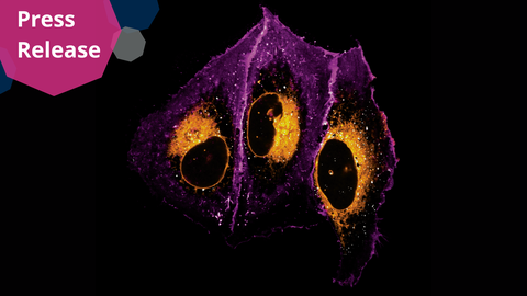 A microscopy picture. The image shows three large, irregularly shaped structures in bright purple with glowing orange centers. Each structure has a dark oval area outlined in orange, giving the impression of a central core. The outer edges of the purple areas are uneven and slightly frayed, while the orange regions appear speckled with bright yellow and white dots. The background is entirely black.