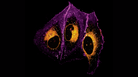 A microscopy picture. The image shows three large, irregularly shaped structures in bright purple with glowing orange centers. Each structure has a dark oval area outlined in orange, giving the impression of a central core. The outer edges of the purple areas are uneven and slightly frayed, while the orange regions appear speckled with bright yellow and white dots. The background is entirely black.