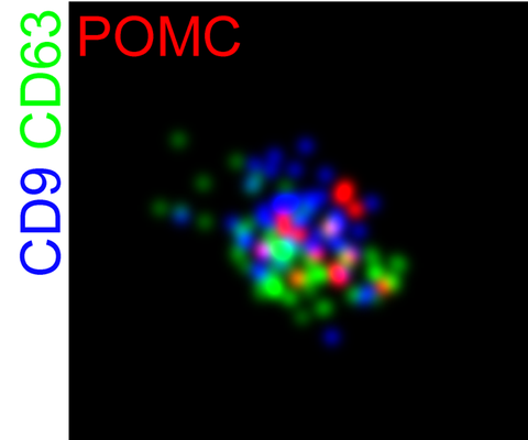 Colorful vesicles are shown against a black background.