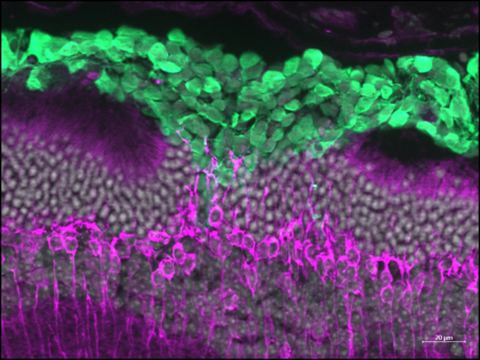 RPE Cells