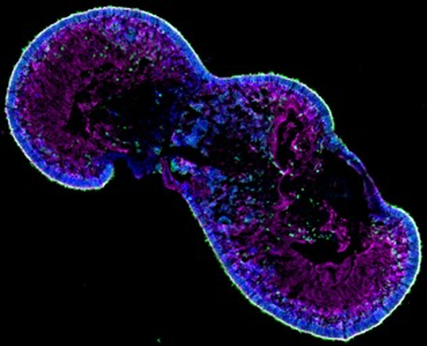 RPE Cells