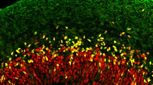 Neural progenitor cells of the developing neocortex. During neurogenesis, neural progenitor cells (SOX2/red; TBR2/yellow) give rise to neurons (TUJ1/green)