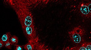 Confocal laser scanning microscopy of bone tissue showing proximity of polynucleated (DAPI in blue) osteoclasts (purple) with eosinophils (green).