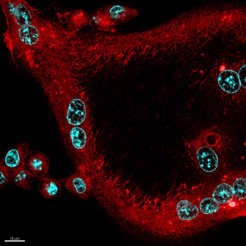 Confocal laser scanning microscopy of bone tissue showing proximity of polynucleated (DAPI in blue) osteoclasts (purple) with eosinophils (green).