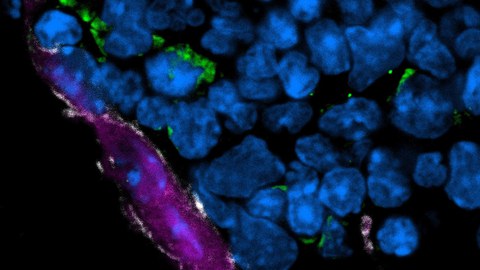 Confocal laser scanning microscopy of f-actin in in vitro differentiated polynucleated (DAPI in cyan) osteoclast (red).