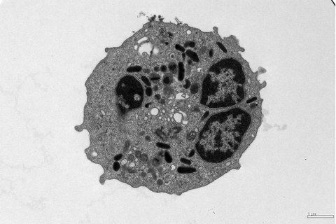 Light sheet fluorescence microscopy of eosinophils (red) in lung tissue.