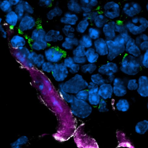 Confocal laser scanning microscopy of bone tissue showing proximity of polynucleated (DAPI in blue) osteoclasts (purple) with eosinophils (green). 