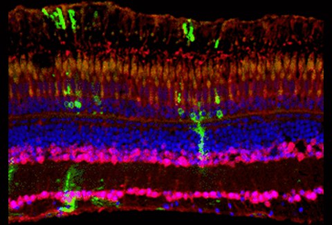 Regeneration of the adult zebrafish retina