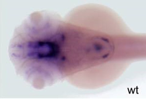 A zebrafish mutant with features reminiscent of human Parkinson’s disease (PD)