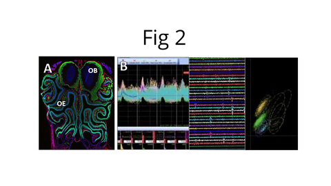An image. It consists of 4 images and a text. The text is in the top middle: “Fig 1”. Below that, Figure 1, which includes four panels (images) labeled A, B, C, and D.  Panel A shows the cover of "Trends in Cell Biology" with an image of Big Ben, and text highlighting the importance of G1 length in controlling neurogenesis. Panel B displays an image of a brain with highlighted sections, indicating a comparison between a control and a 4D condition. Panel C features a stylized illustration of an alien with a large brain and prominent eyes. Panel D presents a colorful microscopy image.