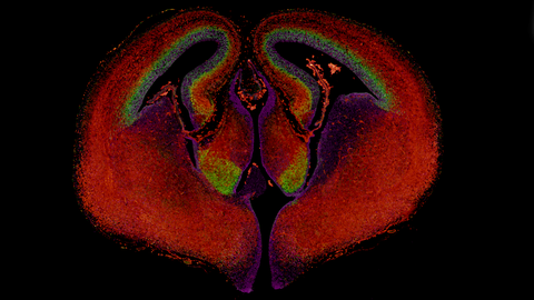 Embryonic Brain