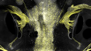 Mikroskopische Fluoreszenzaufnahme auf schwarzem Hintergrund. Spiegelbildlich angeordnete, gelb leuchtende Strukturen links und rechts. Daneben dunkle, ovale Hohlräume. In der Mitte verläuft eine vertikale, hellgelb punktierte Struktur nach oben und unten