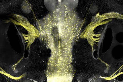 Microscopic fluorescence image on a black background. On the left and right, there are yellow glowing structures arranged like a mirror image.  
