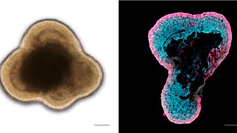Left: Brightfield microscopy image of a living human retinal organoid in cell culture; Right: Immunostained image of a human retinal organoid section labeled for photoreceptors (RCVRN, magenta) and Müller glia (RLBP1, cyan)