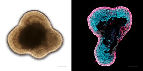 Left: Brightfield microscopy image of a living human retinal organoid in cell culture; Right: Immunostained image of a human retinal organoid section labeled for photoreceptors (RCVRN, magenta) and Müller glia (RLBP1, cyan)