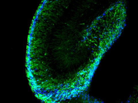 During pre-natal brain development of the hippocampus, stem cells (green) migrate into the region, in which lifelong production of new neurons (“adult neurogenesis”) can be found.