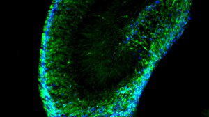 During pre-natal brain development of the hippocampus, stem cells (green) migrate into the region, in which lifelong production of new neurons (“adult neurogenesis”) can be found.