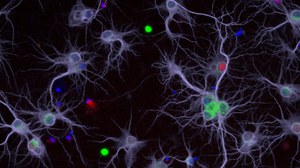 Picture of neurons