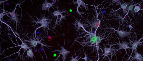 Picture of neurons