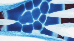 Axolotl hand. Carpal bones located in the centre of the image, radius and ulna to the left, and digits to the right. Alcian blue/Alizarin red staining by Yuka Taniguchi.