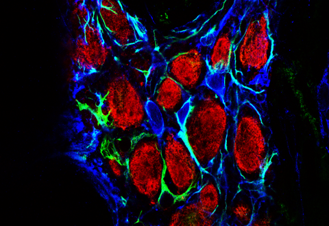 Z-projection of a confocal whole mount of the myenteric plexus within the enteric nervous system. Enteric neurons are shown in red and glia cells in green. 