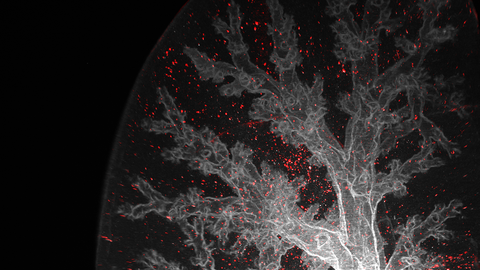 cleared lung 3D