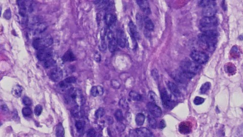 Mucosal Immunology