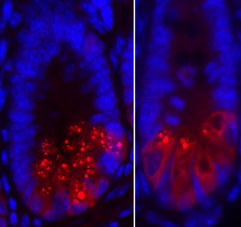 Deficiency in X-linked inhibitor of apoptosis protein (Xiap) 