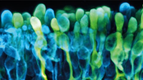 Ein Mikroskopie-Bild. Eine Mischung aus grünen und blauen Formen, die ein bisschen wie Ballons aussehen.