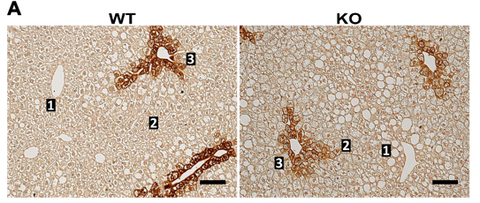 Zonated Steatosis in Tm6sf2-/- Mice