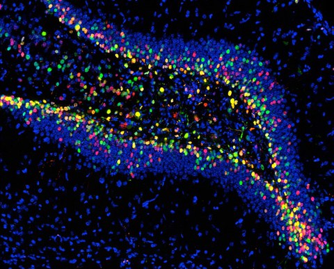 Mouse dentate gyrus infected with viruses expressing either RFP (red) or GFP (green).