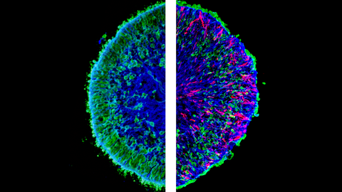 Zwei zusammengesetzte Mikroskopie-Bilder. Jedes Teil ist eine Hälfte eines Kreises und wird so aneinandergelegt, dass sie wie ein Kreis aussehen. Das linke Bild ist mit blauer Farbe gefüllt und hat viel Grün am Rande der Kugel. Das rechte ist mit blauer Farbe gefüllt, hat sichtbar weniger Grün und hat viele rote Fäden.