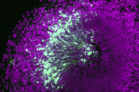 A microscopy image. Colorful, purple, fluorescent dots that radiate from a center and form a sphere, one part is interwoven with white and green dots.