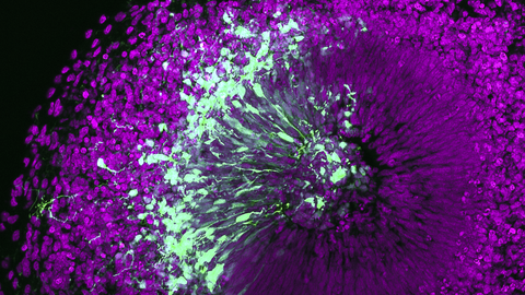 Eine Mikroskopische Aufnahme. Bunte, violette, fluoreszierende Punkte, die von einem Zentrum ausstrahlen und eine Kugel bilden, ein Teil ist mit weißen und grünen Punkten verwoben.