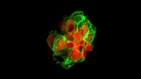 A microscopy image. showing an irregularly shaped cluster of round structures with bright red and green fluorescence on a black background. The cluster consists of multiple overlapping red circular shapes, with green fluorescent outlines and networks interweaving through and around the red areas. The green fluorescence forms intricate, web-like patterns, creating a contrast with the solid red regions.