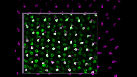 A microscopic image displaying a field of small, round shapes against a dark background. The shapes are predominantly green. Some shapes have magenta-colored spots or protrusions, creating a mixed pattern of green, white, and magenta. The image is overlaid with a rectangular inset, zooming in on a section of the shapes, where the same color patterns are visible, but in greater detail.