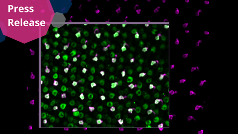 A microscopic image displaying a field of small, round shapes against a dark background. The shapes are predominantly green. Some shapes have magenta-colored spots or protrusions, creating a mixed pattern of green, white, and magenta. The image is overlaid with a rectangular inset, zooming in on a section of the shapes, where the same color patterns are visible, but in greater detail.