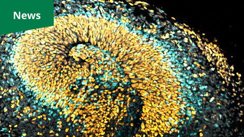 A microscopy picture. Thousands of small, luminous, oval-shaped points in yellow, turquoise, and grey are densely packed against a black background. These points are arranged in sweeping, curved paths that create the appearance of overlapping, folded layers or swirling waves. In the top left corner, a solid green rectangular banner contains the white text "News."