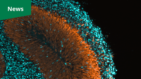 A microscopy picture. On a black background, a large fan-shaped structure is composed of thousands of elongated, orange oval shapes radiating outward from a central line. This orange area is surrounded and partially covered by a dense layer of smaller, bright turquoise circular points. The entire arrangement occupies the left and center of the frame, tapering off into dark space on the right. In the top left corner, a solid green rectangular banner displays the white text "News".