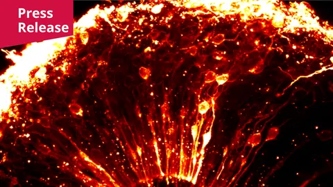 A microscopy image. A structure with glowing shades of red, orange, and white on a black background. Across the top edge of the structure runs a bright, jagged white-to-yellow band. Below it, many thin, bright strands run vertically and fan downward, converging toward a point at the bottom center. Scattered among the strands are rounded, blob-like shapes and small bright specks of varying size.