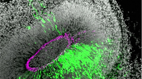 Microscopy image of an eye-like, mostly black and white structure consisting of white dots. In the center is a magenta oval. Outside the magenta oval are green color blobs.