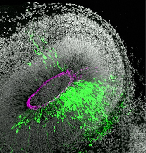 Microscopy image of an eye-like, mostly black and white structure consisting of white dots. In the center is a magenta oval. Outside the magenta oval are green color blobs.